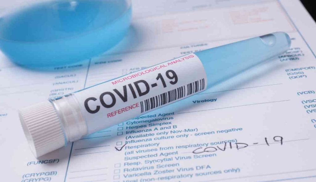 Covid devi restituire i soldi - Aquilatv.it (Fonte Foto Canva)