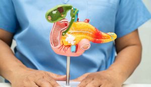 Tumore allo stomaco sintomi da non sottovalutare - Aquilatv.it (fonte foto Canva)